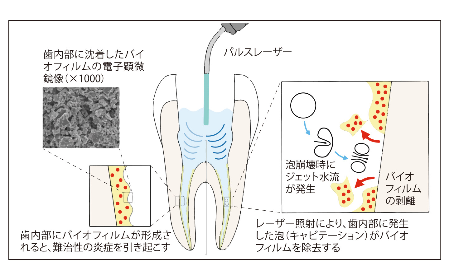 日本歯科新聞 | 2022年4月12日付